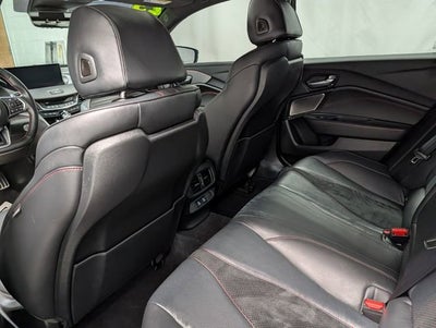 2025 Acura TLX A-SPEC Package
