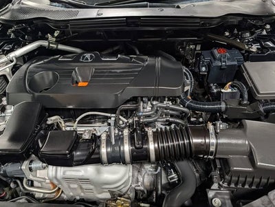 2025 Acura TLX A-SPEC Package