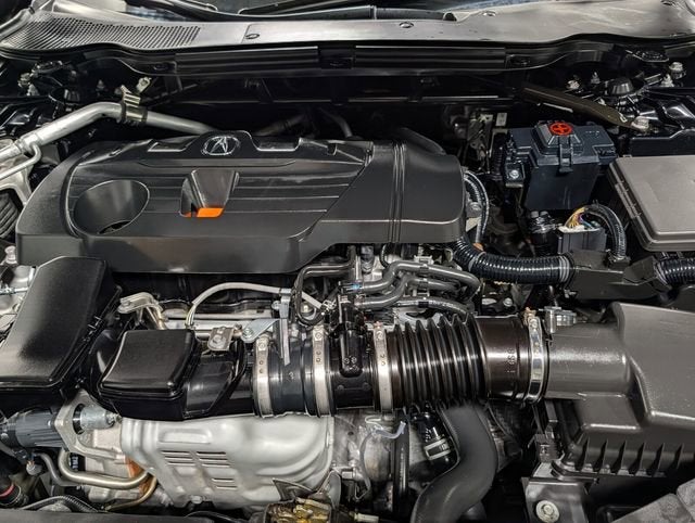 2025 Acura TLX A-SPEC Package